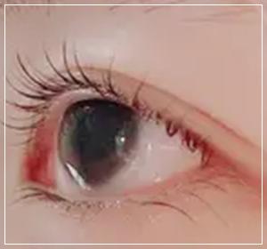 ギャラリー